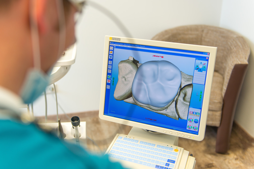 cerec